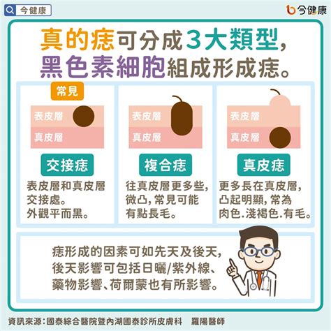 手臂痣長毛代表什麼|是痣？皮膚癌？還是什麼？常見Q&A解惑！醫教揪出「。